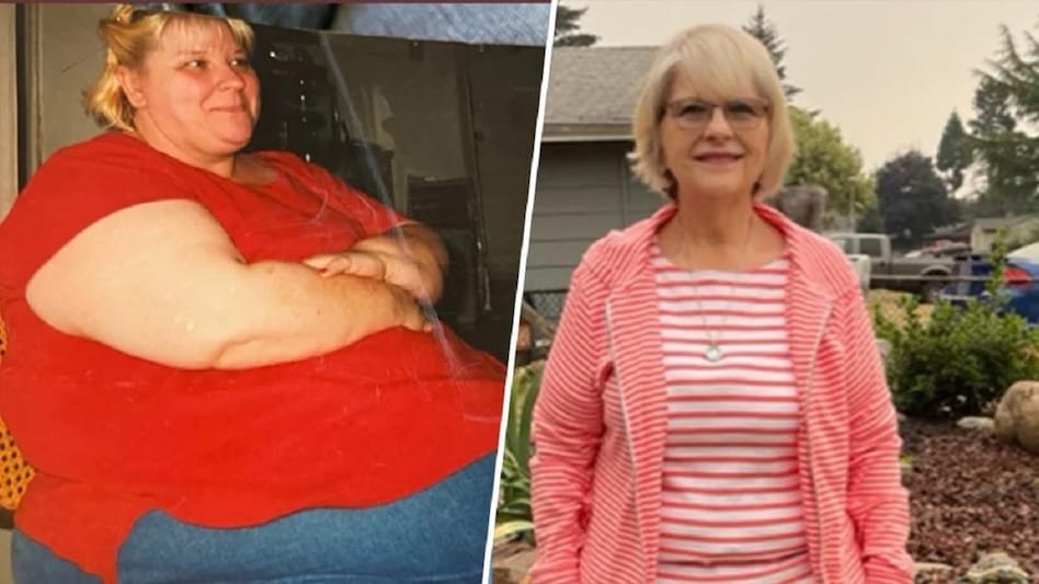 Weight loss: 70 साल की महिला ने घटाया 50 किलो वजन, 80/20 रूल को किया फॉलो - Weight loss 70 year old woman lost 50 kg with the help of 80/20 rule tlifp - AajTak
